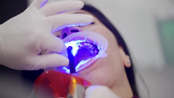 ジルコニアのベニヤ 歯の王冠を結ぶためのUvライトを使用して歯科医の手のクローズアップ 歯科医院で紫外線を使用したセラミックベニヤを設置するプロセス コスメティック歯科 — ストック動画