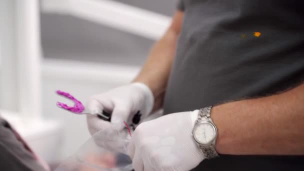 Tandartsen Handen Verpakking Facebow Vork Met Bijtafdruk Van Vrouwelijke Patiënt — Stockvideo