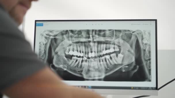Πανοραμική Ακτινογραφία Των Σιαγόνων Στην Οθόνη Αρσενικός Οδοντίατρος Δείχνει Ακτινογραφία — Αρχείο Βίντεο