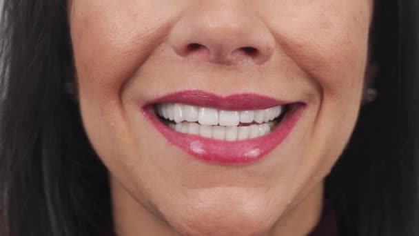 女性在安装了氧化锆饰品 牙釉质冠之后 都会笑得很开心 女性患者在用瓷制牙面处理牙齿后微笑 完美的好莱坞微笑 — 图库视频影像