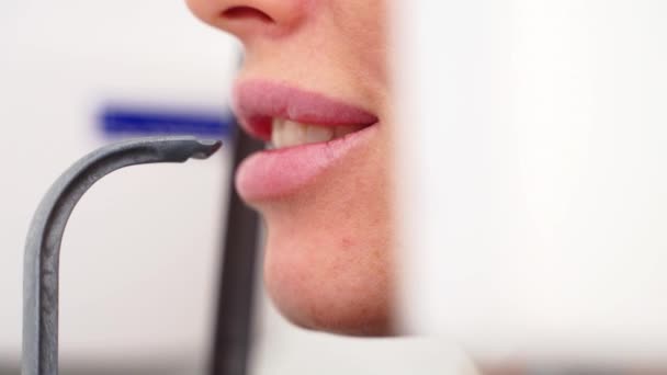 现代牙科诊所的女病人嘴做全明牙X光检查 医院医疗柜X光机扫描仪中的女病人 年轻女人用下巴拍全景 后续行动 — 图库视频影像