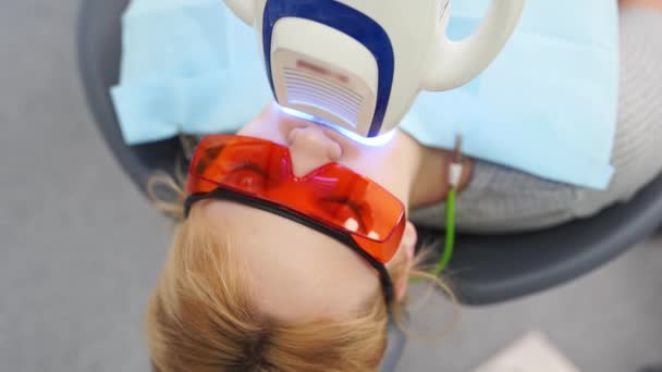 Крупним Планом Жіноче Обличчя Пацієнта Лазерному Відбілюванні Зубів Сучасному Стоматологічному — стокове відео