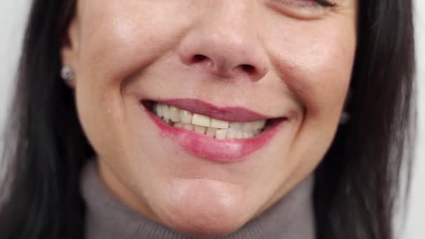 在用氧化锆牙膏对牙齿进行整容治疗之前 对女性的微笑进行近距离观察 女病人在安装牙刷 牙冠前微笑 现代牙整形 — 图库视频影像