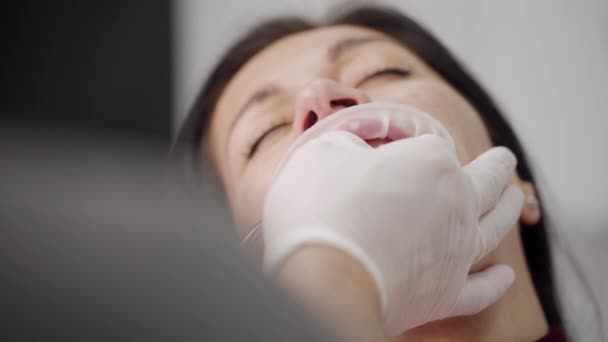 Zirkon Kaplamaları Yerleştirme Işlemi Diş Hekimlerinin Elleri Kaplama Için Ultraviyole — Stok video