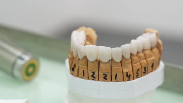 在现代牙科实验室为病人准备的氧化锆毒液和牙冠的特写 非常好的牙釉质植入物 可供牙科使用 完美的白色微笑 现代牙整形 — 图库视频影像