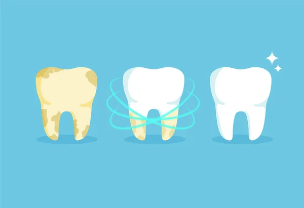 Очищення Зубів Білосніжний Жовтий Зуб Після Відбілювання Концепція Стоматологічного Здоров — стоковий вектор