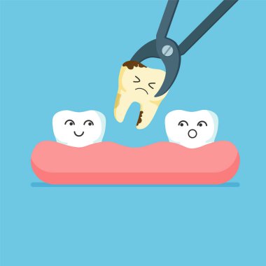 Cartoon tooth is removed by forceps. Teeth row with dental implant. Vector illustration isolated on blue background.