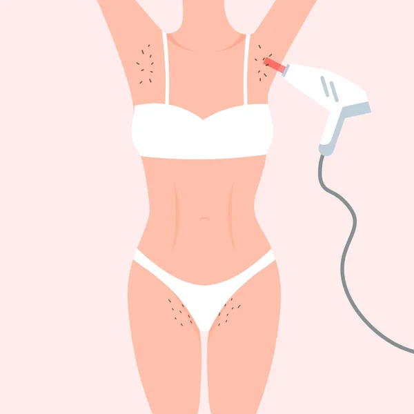 Laserhårborttagning Kvinnliga Håriga Armhålor Och Bikini Område Kvinnlig Skönhetssalong Affisch — Stock vektor