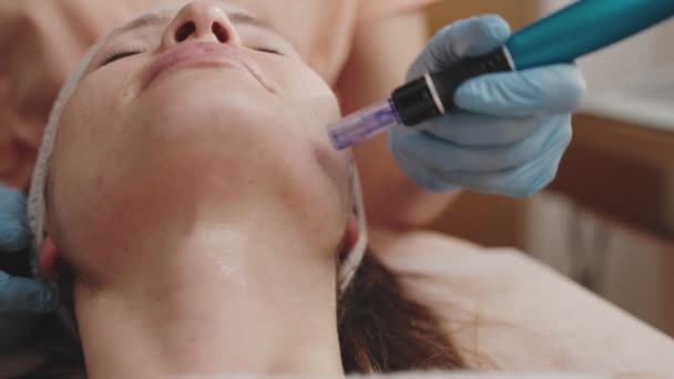 Close Dermatologista Profissional Usando Uma Caneta Derma Rosto Pacientes Durante — Vídeo de Stock