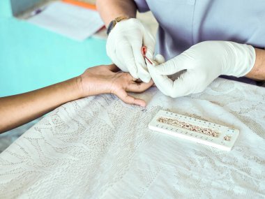 Kılcal tüp ile hematokrit santrifüj plakası Hematokrit mikro santrifüj Hematokrit kan kontrol ekipmanıdır..