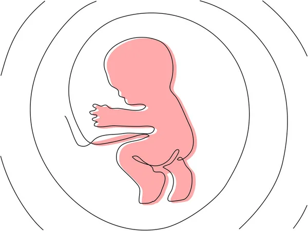 Embrione Una Linea Con Silhouette Colorata Concetto Gravidanza Con Feto — Vettoriale Stock