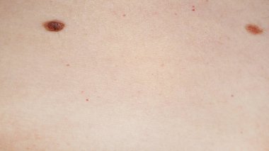 İki benli açık bir cilt, cilt sağlığı muayenesi için kullanışlı..