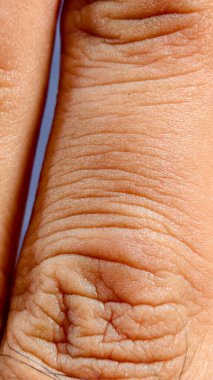 close up of human skin with veins