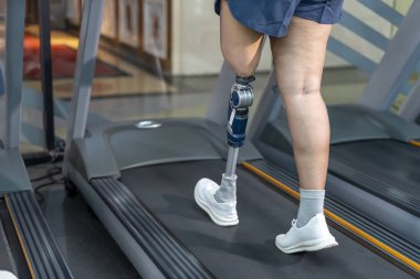 Beden eğitiminde koşu bandında yürüyen protez bacaklı bir kadın, spor salonunda egzersiz yapan bir kadın.