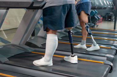 Protez bacaklı insanlar koşu bandında yürüyor, engelli sporcular spor salonunda spor yapıyor.
