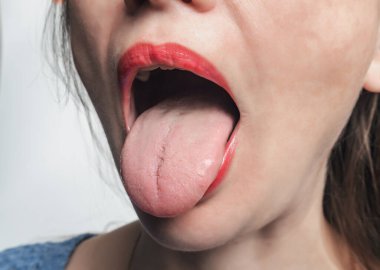 woman demonstrates her tongue