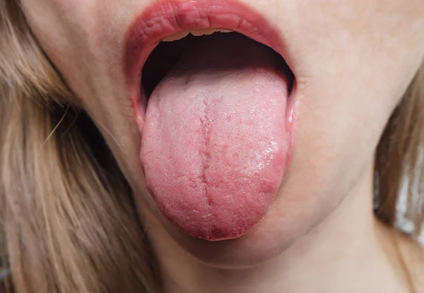 woman demonstrates her tongue