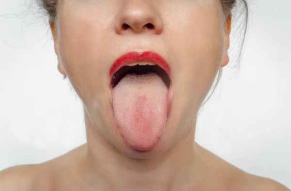 Front view of woman\'s face with her tongue sticking out. Treatment of ENT diseases.