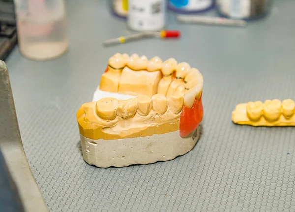 Odlew Gipsowy Szczęki Gabinecie Technika Dentystycznego — Zdjęcie stockowe
