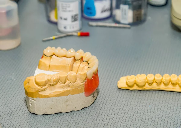 Odlew Gipsowy Szczęki Gabinecie Technika Dentystycznego — Zdjęcie stockowe