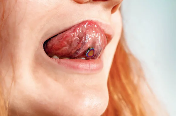 Zungenpiercing Gesicht Einer Frau Die Zunge Ist Nach Oben Gestreckt — Stockfoto