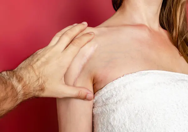 Stock image Man hand examines a postoperative scar on a woman shoulder. Healing of scars, treatment of scars on the skin