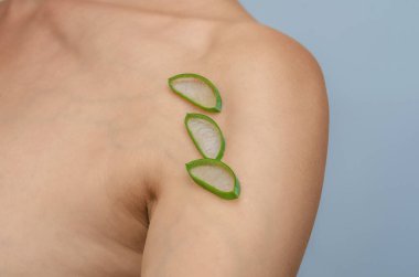 Omzunda yara izi. Aloe Vera, ameliyat sonrası kadının omzunda yara izi bırakıyor. Yara iyileşme, ciltteki yaraların tedavisi..