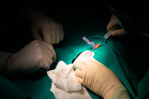 Primer Plano Las Manos Cirujano Que Opera Una Lesión Dermatológica —  Fotos de Stock