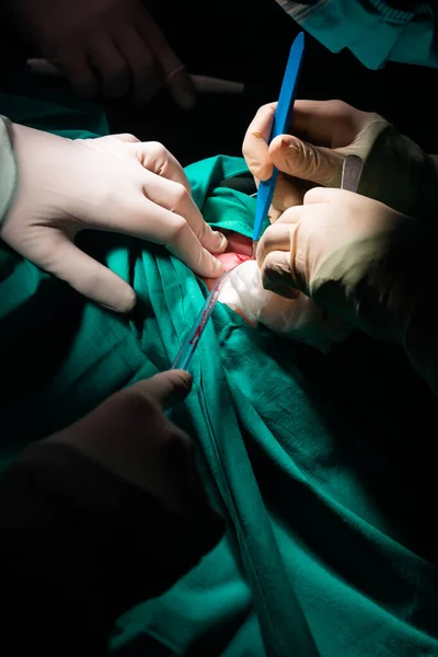 Close Das Mãos Cirurgião Fazendo Uma Incisão Pele Paciente Bisturi — Fotografia de Stock
