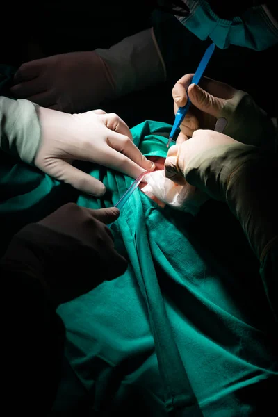 Close Surgeon Hands Making Incision Patient Skin Sterile Scalpel Aspirator — Stock Photo, Image
