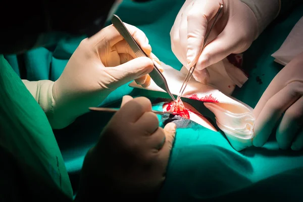 Detailní Záběr Rukou Chirurga Operujícího Dermatologické Lézi Fibroidu Resekce Skalpelem — Stock fotografie