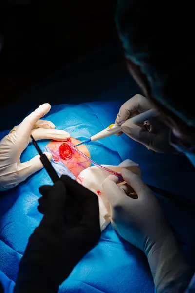 Ameliyathanede dermatolojik ameliyat. Lezyonun pıhtılaşması ve sıvı emisyonu. Epidermoid karsinom. Bir cerrahın elleri ve asistanının bir hastanın yüzüne müdahale etmesi. Dikey