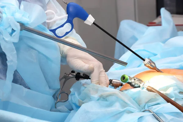 Mideden Ameliyat Ameliyathanede Cerrahi Müdahaleyle Tedavi Edilen Bir Hastanın Tıbbi — Stok fotoğraf