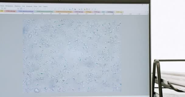 Läkaren Undersöker Spermaproverna Mikroskop Vetenskapsman Spermalaboratoriet Labbarbetare Reglerar Ett Mikroskop — Stockvideo