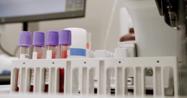 Tüplü kan testi makinesi. Kan Test Makinesi Örnekleri Kontrol Ediyor. Otomatik makine çalışma sürecinde, kan ve idrar örneği analizi. Biyoloji Laboratuvarı Tıbbi Kliniği Kimyasal Otomatik Analizleyici.