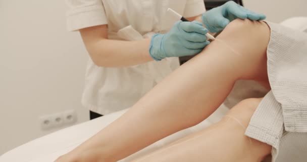 Πόδια Ασθενούς Έτοιμα Για Αποτρίχωση Λέιζερ Όμορφα Λεπτά Γυναικεία Πόδια — Αρχείο Βίντεο