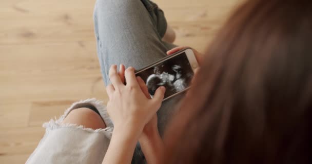 Lesbianas Esperando Bebé Abrazando Mirando Imagen Ultrasonido Derechos Lgbt Familia — Vídeos de Stock