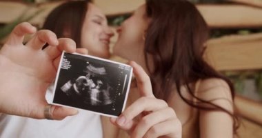 Lezbiyenler bebeğin kucaklaşmasını, bakmasını ve ultrason resmini göstermesini bekliyorlar. Sarılın ve birbirinize sarılın. Sevgiler LGBTQI. LGBT hakları, Kadın Lgbt çifti evde dinleniyor. Lezbiyen ailesi.