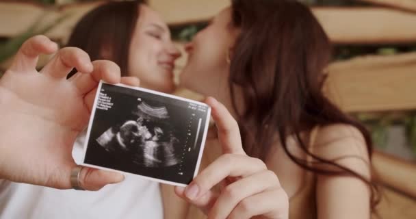 Lesbianas Esperando Bebé Abrazando Mirando Mostrando Imagen Del Ultrasonido Abrazaros — Vídeo de stock