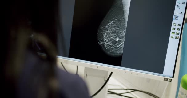 Escaneo Senos Monitor Computadora Aparato Mamografía Hospital Moderno Inyección Manual — Vídeos de Stock