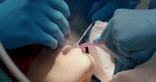 Стоматолог Робить Чистку Зубів Пацієнта Сучасній Клініці Гігієна Ротової Порожнини — стокове відео