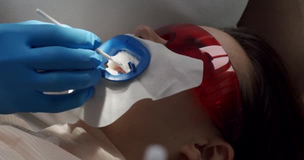 Zubař Dělá Čištění Zubů Pro Pacienta Zubní Moderní Klinice Moderní — Stock video