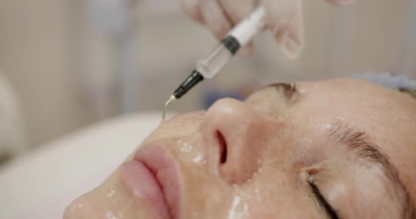 美容院で若返りの手続きをするクライアントの顔に注射器を塗った女性美容師のクローズアップ 化粧品とフェイススキンケアのコンセプト — ストック動画