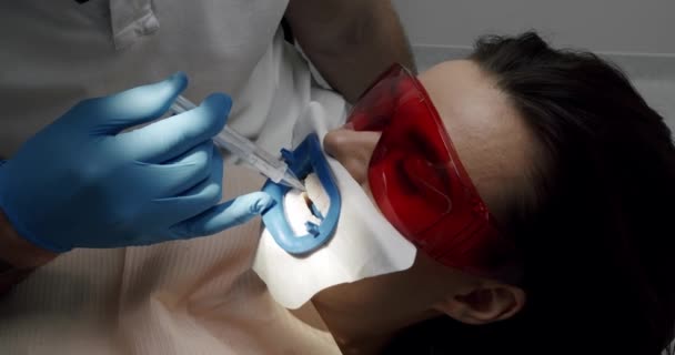 Tandläkare Gör Tandrengöring För Patienten Tandläkarmottagningen Munhygien Och Förebyggande Rengöring — Stockvideo
