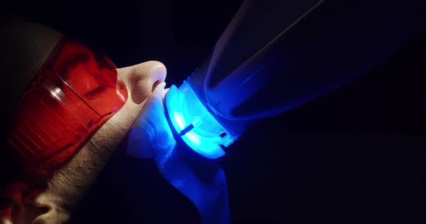Zahnaufhellung Beim Zahnarzt Zahnaufhellungsverfahren Mit Licht Einer Modernen Klinik Patientin — Stockvideo