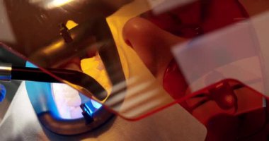 Diş hekiminin ofisinde diş beyazlatma. Modern bir klinikte ultraviyole ışık feneriyle diş beyazlatma prosedürü. Diş Kliniği Diş beyazlatma. Dişçi koltuğunda koruyucu gözlüklü bir hasta..