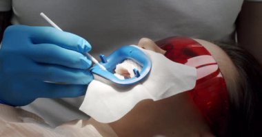 Diş hekimi, modern diş sağlığı kliniğinde hasta için diş temizliği yapıyor. Ağız temizliği ve prezervatif temizliğini kapat. Diş hijyenik diş temizliği yapan kadın hasta..