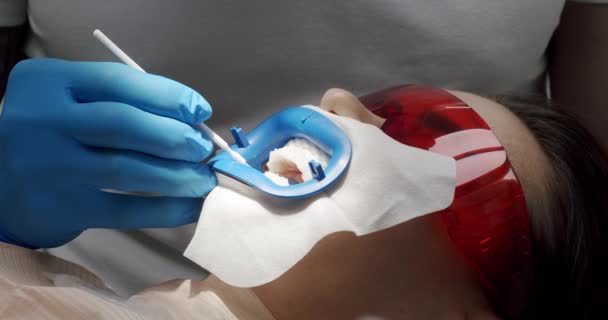 Dentysta Czyści Zęby Dla Pacjenta Nowoczesnej Klinice Stomatologicznej Zamknąć Higienę — Wideo stockowe