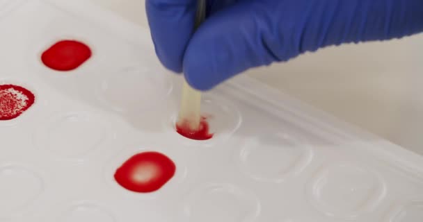 用凝集法测定血型和Rh因子 在实验室进行微生物学研究时 医生戴上医用手套进行检查 血型测定 — 图库视频影像