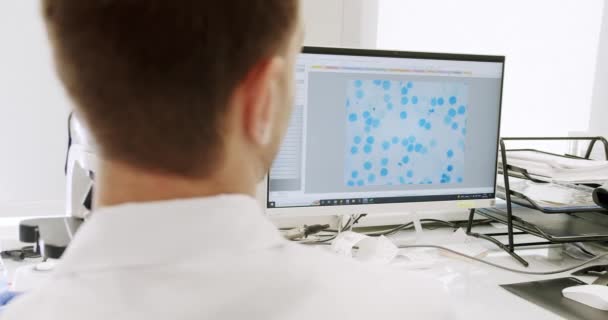 用显微镜检查病人的血液健康状况 在诊所验血的显微镜 高科技显微镜设备下的血液检测 — 图库视频影像